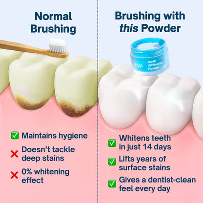 ✨ HZA Teeth Whitening Powder – Brighter Smile Care